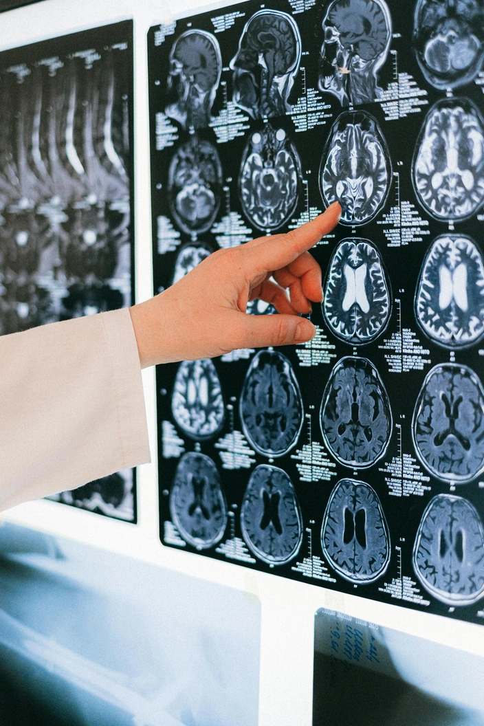 రక్త-మెదడు కంచె గురించి వివరణ | Blood Brain Barrier